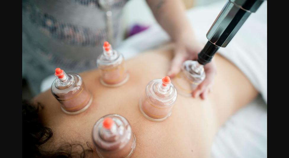 Cupping Massage